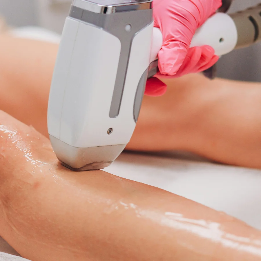 Profissional utilizando aparelho para depilação na perna